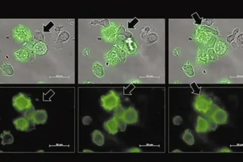 免疫细胞沉睡之谜：血癌细胞的“致命之吻”