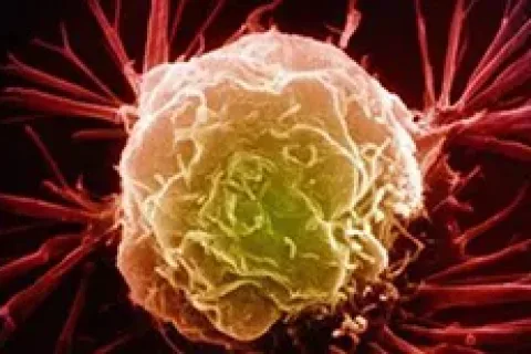 英国多家科研机构携手突破癌症放射治疗新方法