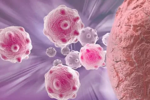 新型超声波技术精准靶向歼灭癌细胞