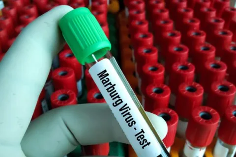 加纳首次确诊马尔堡病例：两例死亡，近百接触者隔离观察