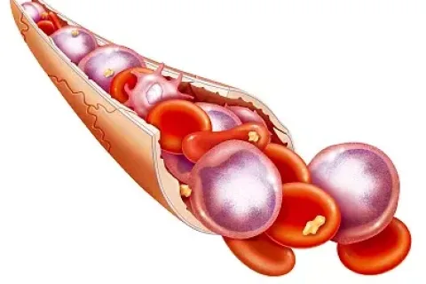 肿瘤的致命弱点被发现