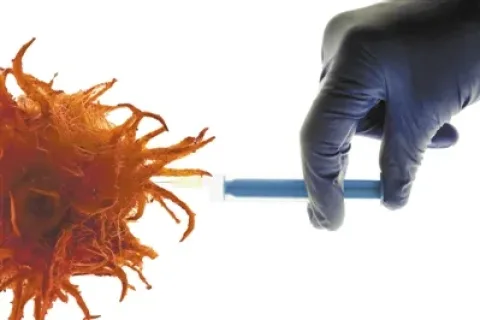 国产CAR-T疗法挑战实体瘤新突破