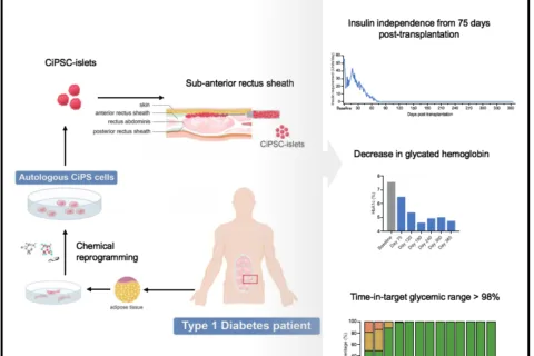我国科学家首次利用干细胞再生疗法功能性治愈1型糖尿病