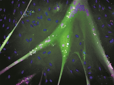 “永生”干细胞培养肉诞生 有望为人造肉提供潜在的无限来源