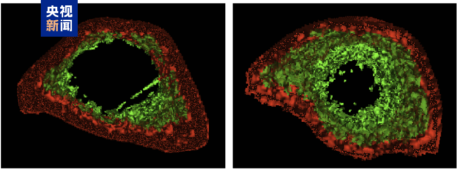 我国科学家在灵长类抗衰老研究领域获新进展
