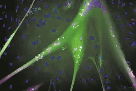 “永生”干细胞培养肉诞生 有望为人造肉提供潜在的无限来源