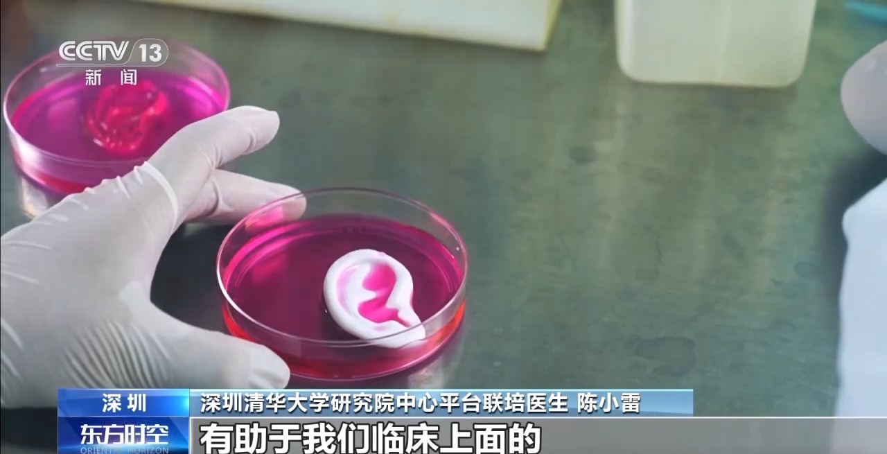 耳朵、骨骼、心脏……探秘神奇的“生物打印”