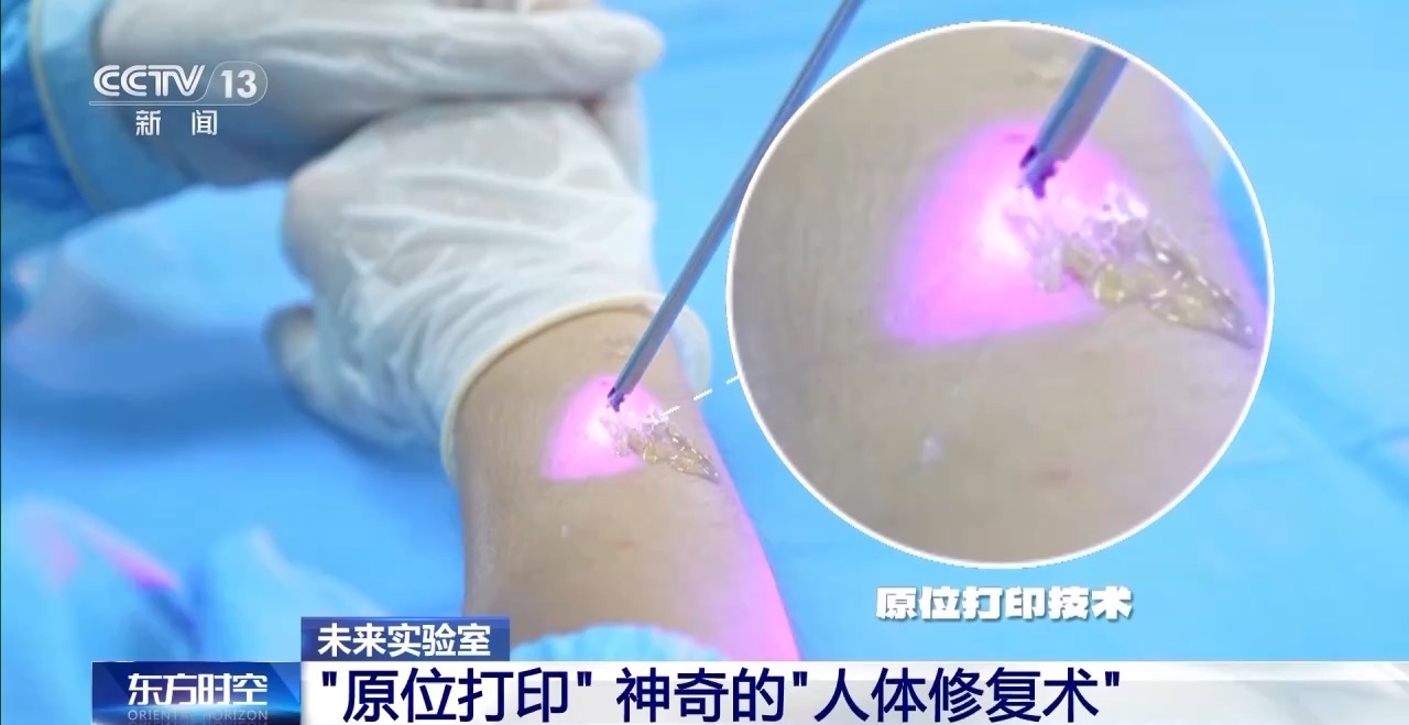 耳朵、骨骼、心脏……探秘神奇的“生物打印”