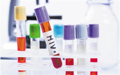 造血干细胞移植疗法 距离成为艾滋病克星还很遥远